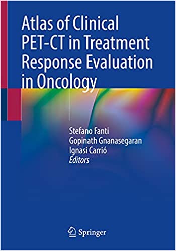 Atlas of Clinical PET CT in Treatment Response Evaluation in Oncology