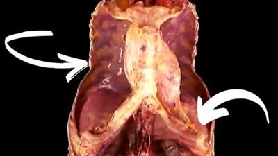 Sistema Respiratório: Aprende Anatomia Humana