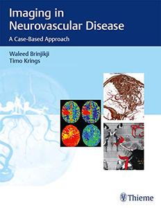 Imaging in Neurovascular Disease A Case-Based Approach