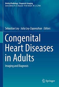 Congenital Heart Diseases in Adults Imaging and Diagnosis 