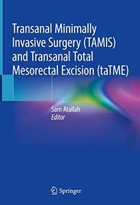Transanal Minimally Invasive Surgery (TAMIS) and Transanal Total Mesorectal Excision (Repost)