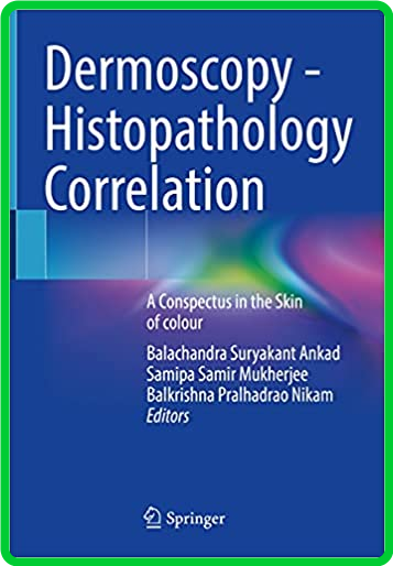 Dermoscopy - Histopathology Correlation - A Conspectus in the Skin of colour ()