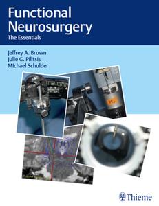 Functional Neurosurgery  The Essentials