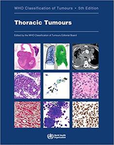 Thoracic tumours Who Classification of Tumours, 5th Edition
